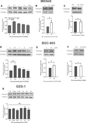 Lysophosphatidic Acid–Induced EGFR Transactivation Promotes Gastric Cancer Cell DNA Replication by Stabilizing Geminin in the S Phase